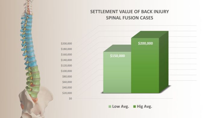 Average Compensation in Spinal Cord Injury Settlements