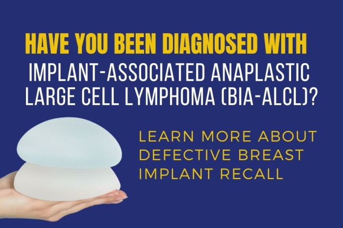 Allergan Textured Breast Implant Lawyers – Yost Law