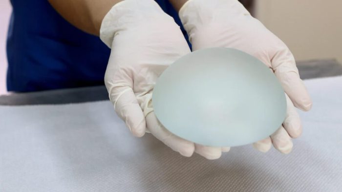 Allergan Biocell Textured Breast Implant Lawsuits - ASK LLP